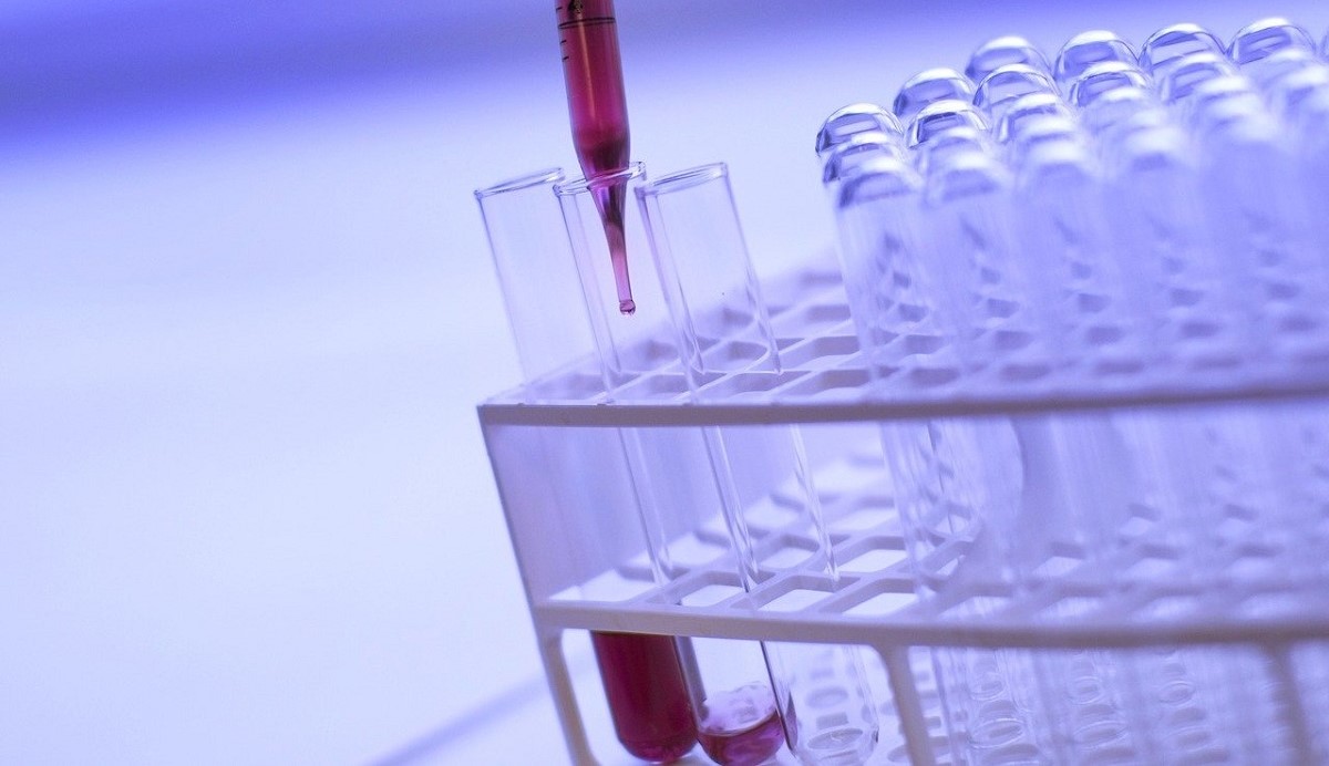 Numab Therapeutics raises 100 million Swiss francs. Image: Pixabay