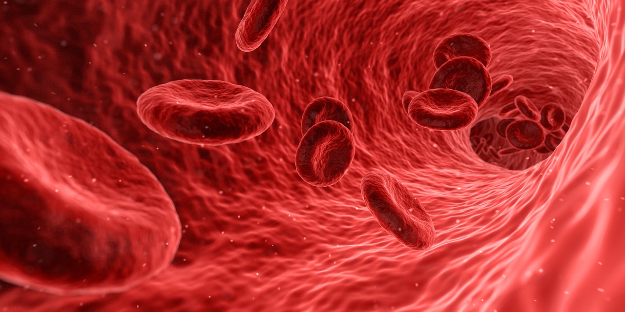 Hämophilie A ist eine Blutgerinnungsstörung.