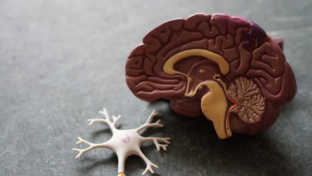 Dividat focused on further developing therapy device