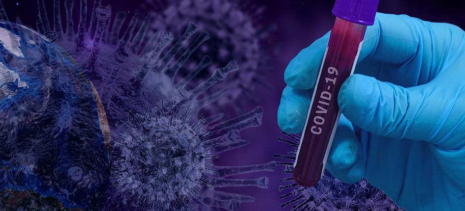 MetrioPharma receives EU grant for covid-19 project